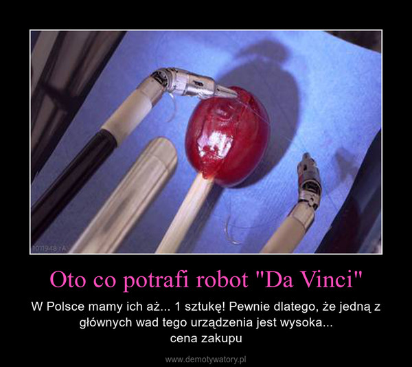 Oto co potrafi robot "Da Vinci" – W Polsce mamy ich aż... 1 sztukę! Pewnie dlatego, że jedną z głównych wad tego urządzenia jest wysoka...cena zakupu 