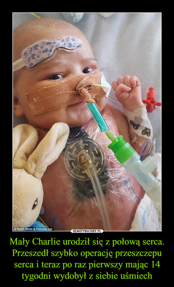 Mały Charlie urodził się z połową serca. Przeszedł szybko operację przeszczepu serca i teraz po raz pierwszy mając 14 tygodni wydobył z siebie uśmiech –  