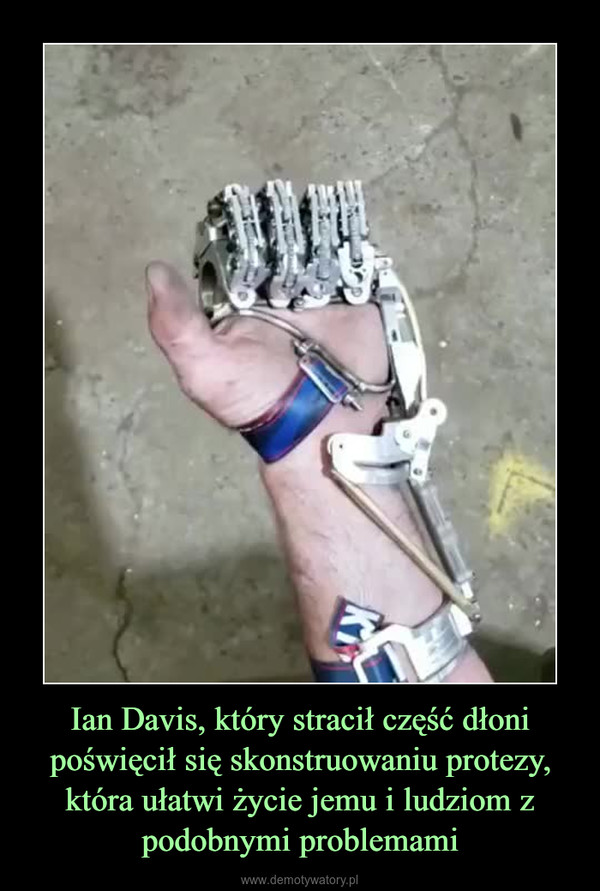 Ian Davis, który stracił część dłoni poświęcił się skonstruowaniu protezy, która ułatwi życie jemu i ludziom z podobnymi problemami –  