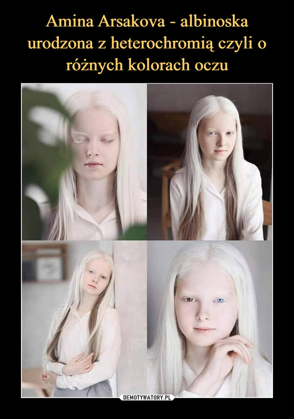 Amina Arsakova - albinoska urodzona z heterochromią czyli o różnych kolorach oczu