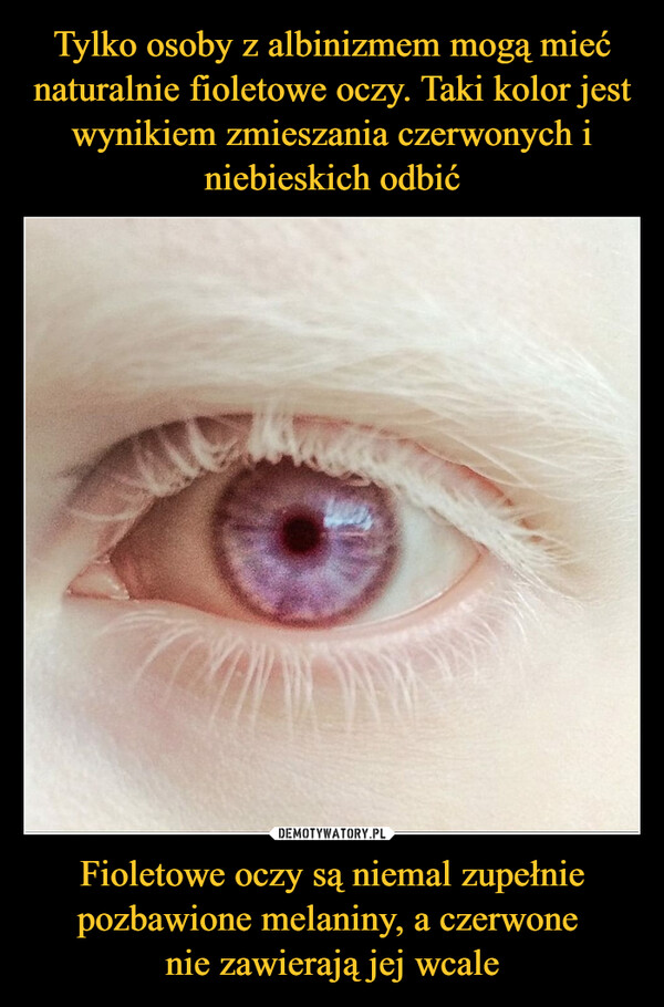 Tylko osoby z albinizmem mogą mieć naturalnie fioletowe oczy. Taki kolor jest wynikiem zmieszania czerwonych i niebieskich odbić Fioletowe oczy są niemal zupełnie pozbawione melaniny, a czerwone 
nie zawierają jej wcale